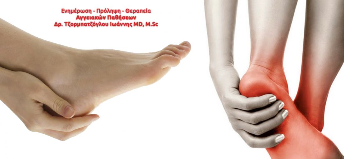 Αγγειοχειρουργός M.D, M.Sc - Aggeia.eu - Δέκα απλές συμβουλές προστασίας ποδιών ασθενών με διαβήτη