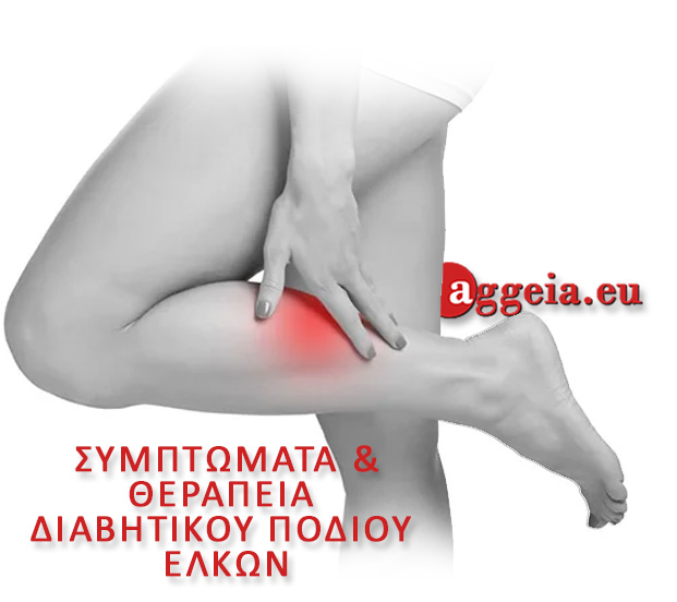 ΘΕΡΑΠΕΙΑ ΔΙΑΒΗΤΙΚΟΥ ΠΟΔΙΟΥ/ΕΛΚΩΝ - Aggeia.eu - elkoi-podion - Διαβητικό πόδι - Περιφερική αγγειακή νόσος