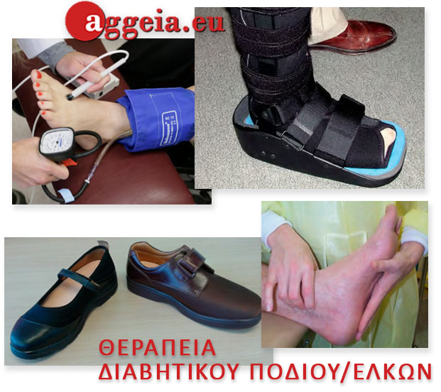 προχωρημένη βλάβη τύπου Charcot - Ulcers - Diabetic Foot - ΘΕΡΑΠΕΙΑ ΔΙΑΒΗΤΙΚΟΥ ΠΟΔΙΟΥ/ΕΛΚΩΝ - Aggeia.eu - elkoi-podion - Διαβητικό πόδι - Περιφερική αγγειακή νόσος