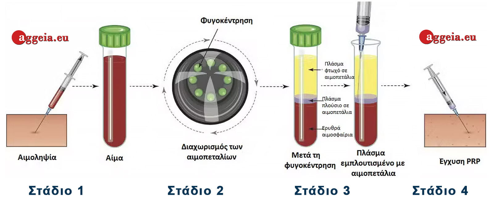 Aggeia.eu-PRP-Diadikasia